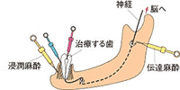 矯正歯科
